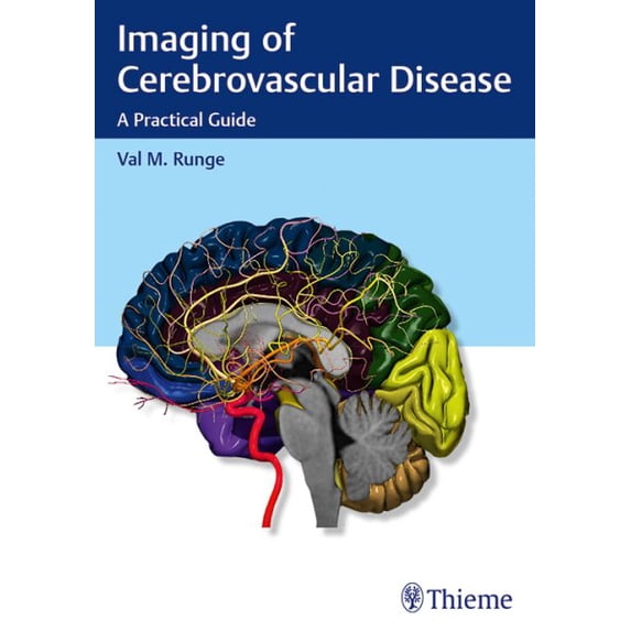 Imaging of Cerebrovascular Disease: A Practical Guide (Paperback)