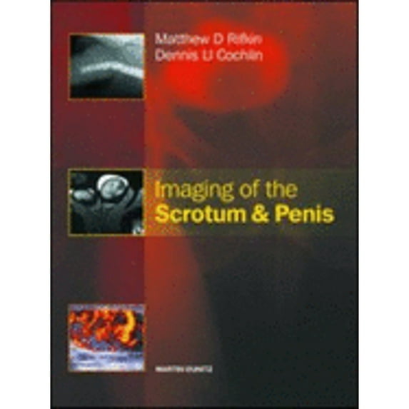 Imaging of the Scrotum & Penis (Hardcover) by Matthew Rifkin, Dennis L Cochlin