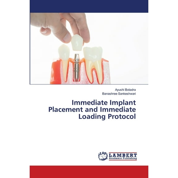 Immediate Implant Placement and Immediate Loading Protocol, (Paperback)