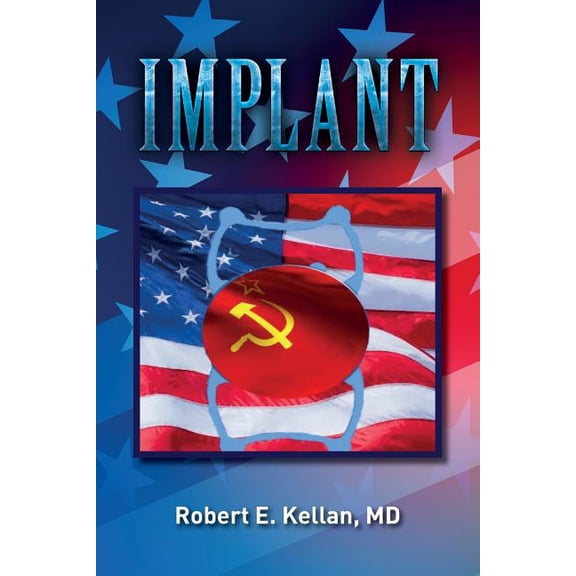 Implant