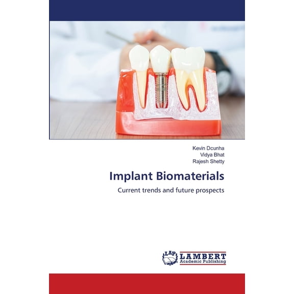 Implant Biomaterials, (Paperback)
