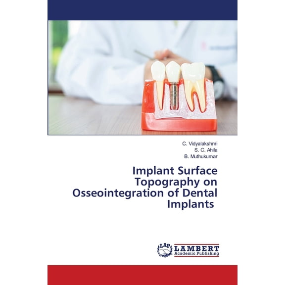 Implant Surface Topography on Osseointegration of Dental Implants, (Paperback)