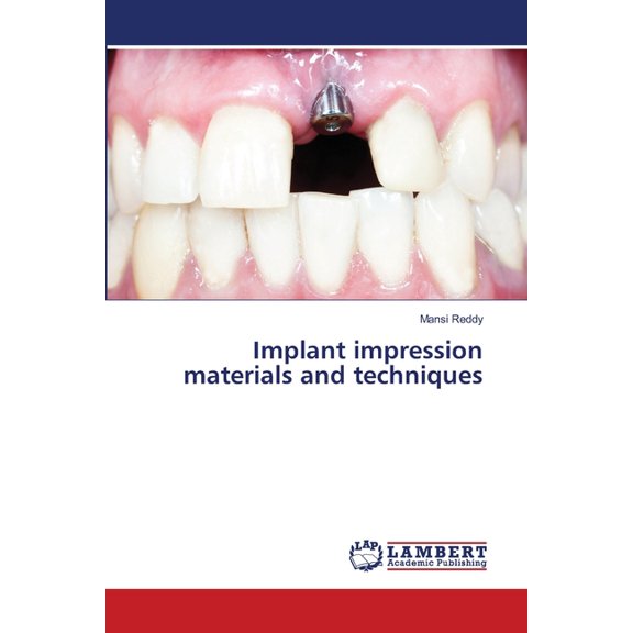 Implant impression materials and techniques, (Paperback)