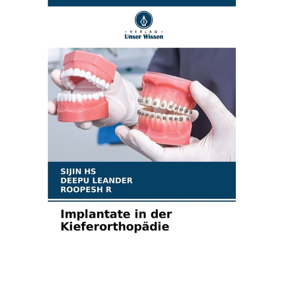Implantate in der KieferorthopÃ¤die, (Paperback)