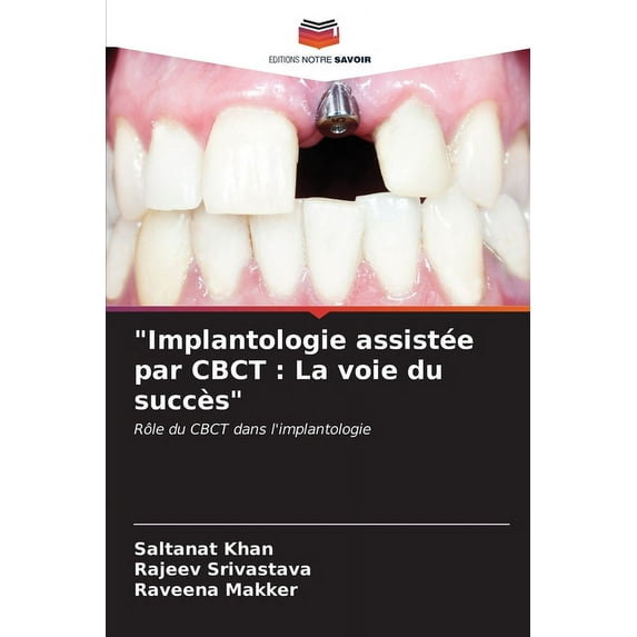 "Implantologie assistée par CBCT: La voie du succès" (Paperback)