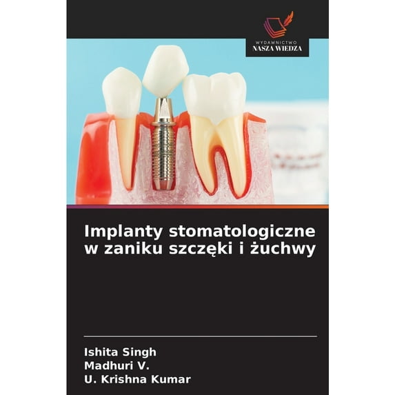 Implanty stomatologiczne w zaniku szczęki i żuchwy, (Paperback)