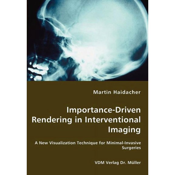 Importance-Driven Rendering in Interventional Imaging - A New Visualization Technique for Minimal-Invasive Surgeries, (Paperback)