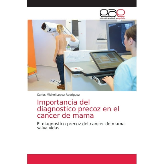 Importancia del diagnostico precoz en el cancer de mama, (Paperback)