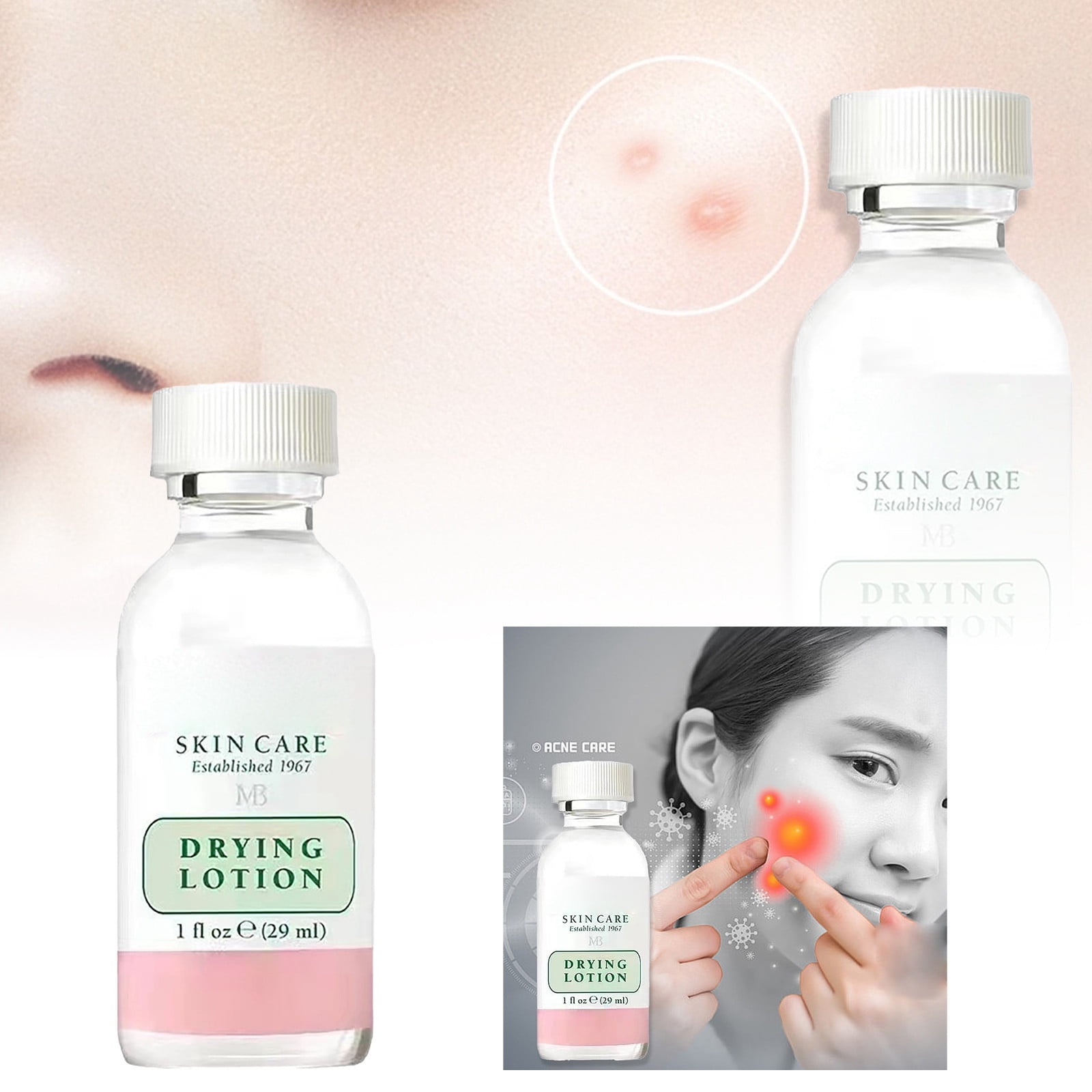 Say Goodbye To Big Blackheads With These Expert Tips - s0mwqok