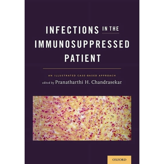 Infections in the Immunosuppressed Patient: An Illustrated Case-Based Approach, (Paperback)