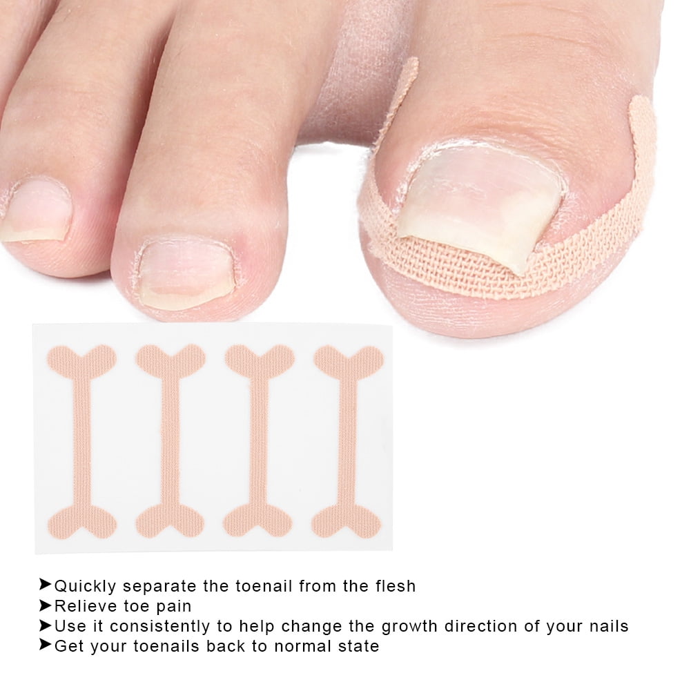 Big Toe Pain: 8 Causes & How to Find Relief | Buoy