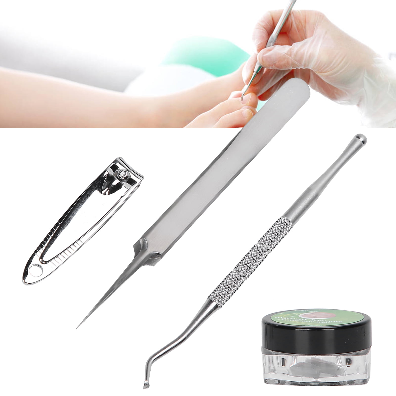 Ingrown Toe Nail Correction Set, Nail Correction Pad, Nail Clipper