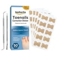 thumbnail image 1 of Ingrown Toenail Correction Kit, 50-Piece with Toenail File & Lifter, 1 of 8