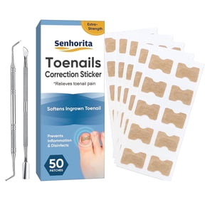 Ingrown Toenail Correction Kit, 50-Piece with Toenail File & Lifter