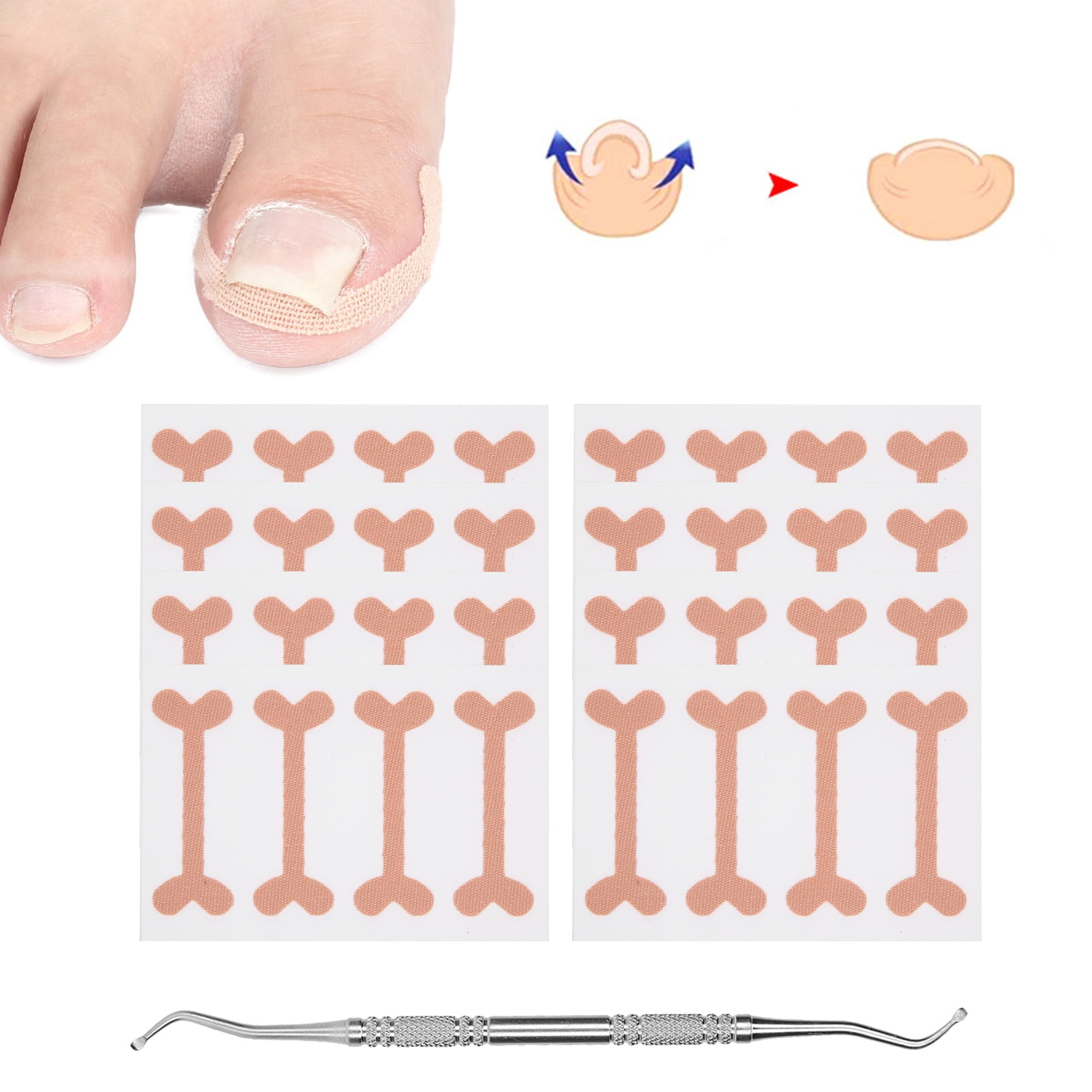Ingrown Toenail Correction Sticker, 9pcs Ingrown Toenail Correction Stickers Self Adhesive