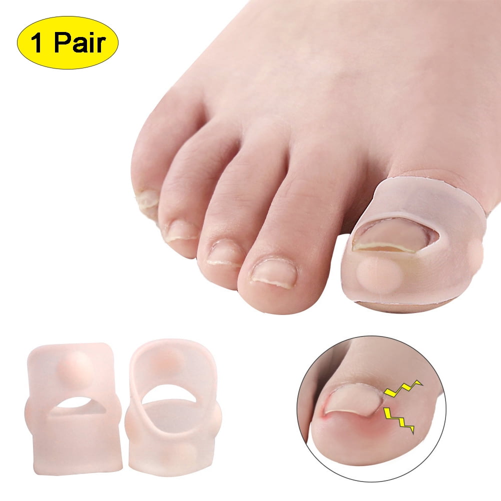 Ingrown Toenail Correction Tool Elastic Toenail Straightening Clip
