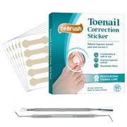 Ingrown Toenail Correction Treatment Tool, No Glue 60Pcs Ingrown Toe nail Corrector Patch, Professional Ingrown Toenail Sticker with 2 Pedicure Tools for Ingrown Toenail Remover ?