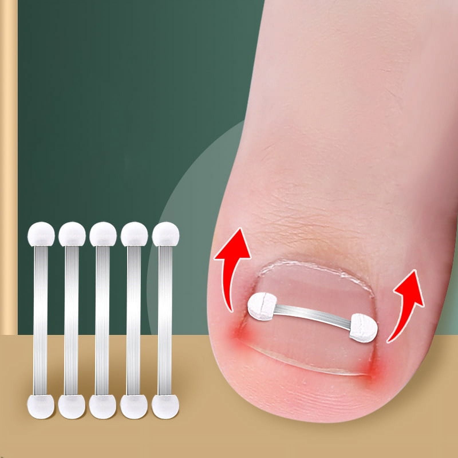 Ingrown Toenail Corrector Tools Pedicure Recover Embed Toe Nail