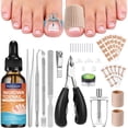 thumbnail image 1 of Ingrown Toenail Removal Kit, Professional Ingrown Toenail Tool Kit Includes Ingrown Toenail Corrector Drops, Corrector Patch, Toenail Clipper, Nail File Lifter Pedicure Tools, 1 of 4