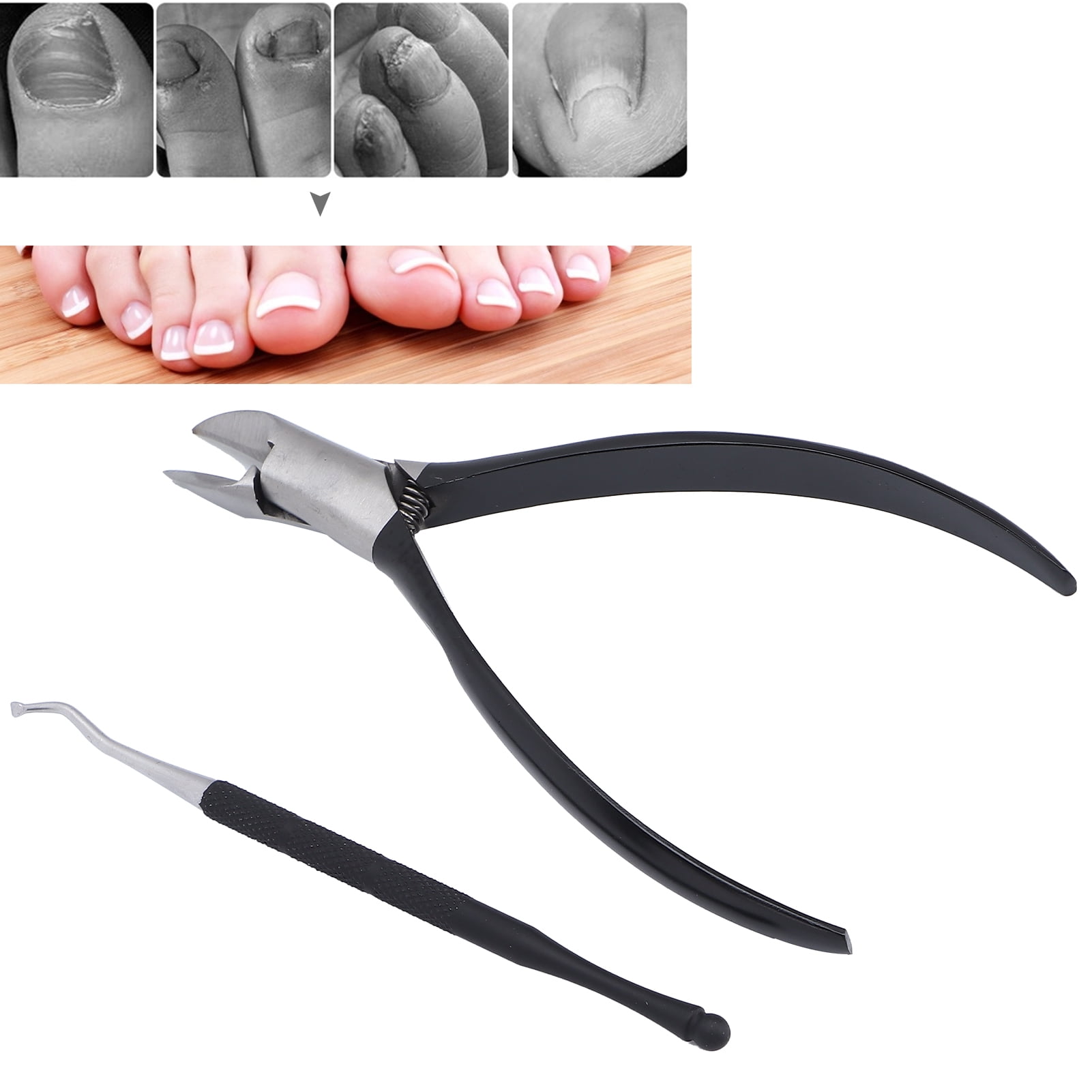 Ingrown Toenail Set Toenail Nippers Toenail Lifter Professional