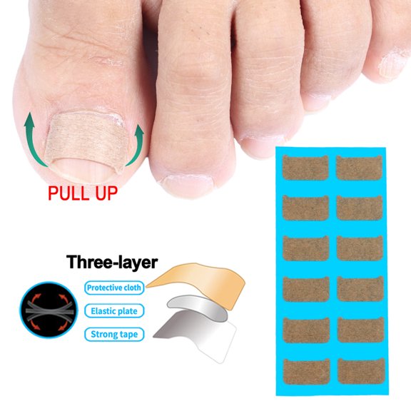 Ingrown Toenail Stickers,Nails Suitable Nail Care Recover Toe Nail Recover Nail Stickers Nail Toenail Stickers Diy Radirus Solution Radirus Solution Nebublu Diy Nail Dsfen Nail Dsfen Nails