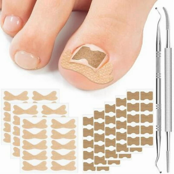 Ingrown Toenail Treatment,50Breathable Corrector Patch,30Ingrown Toenail Strips