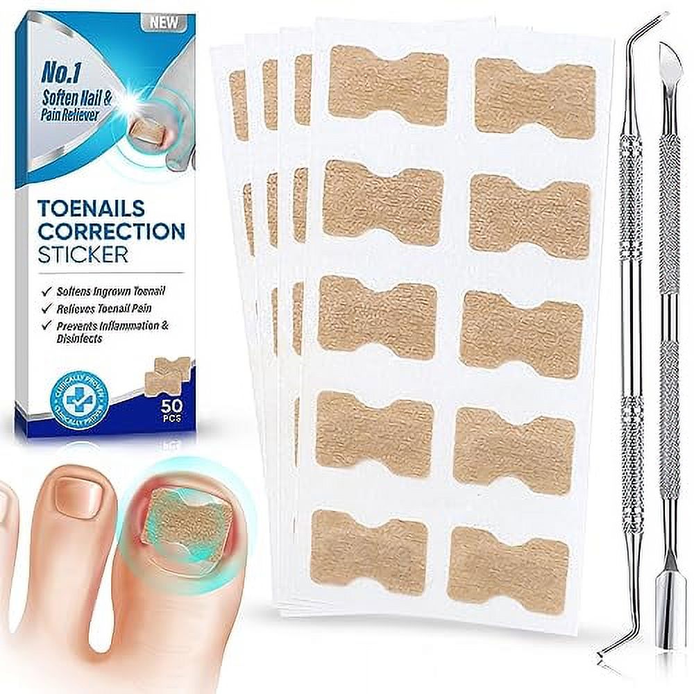 Ingrown Toenail Treatment, No Glue 50Pcs Breathable Toenail Corrector