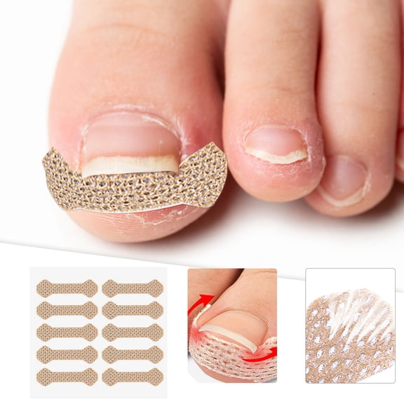 Ingrown Toenail Treatment Strips, 200 Pcs Breathable Toenail Corrector Patch for Home Pedicure Care