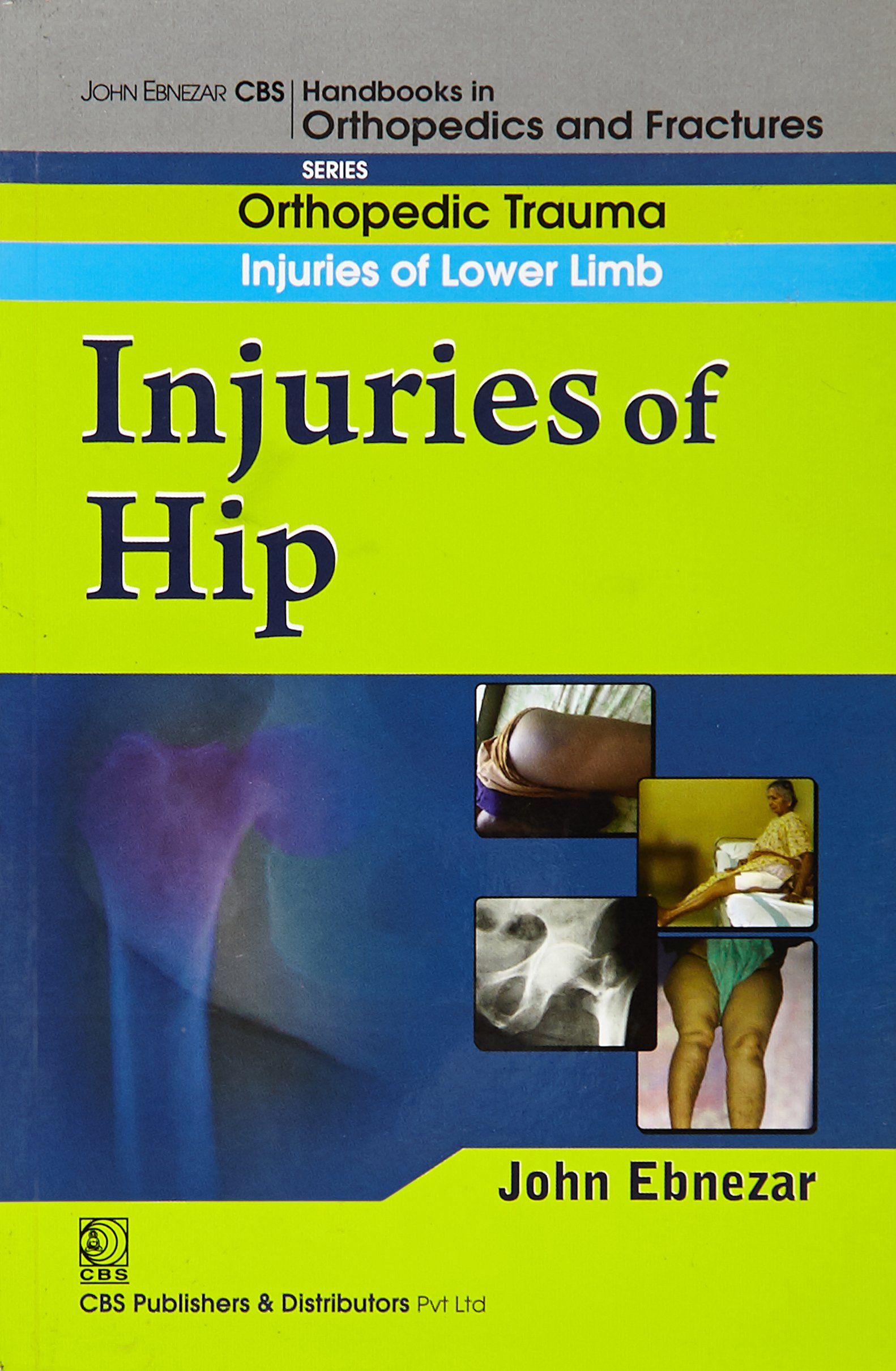 Injuries Of Hip (Handbook Of Orthopedics And Fratures Series, Vol. 13
