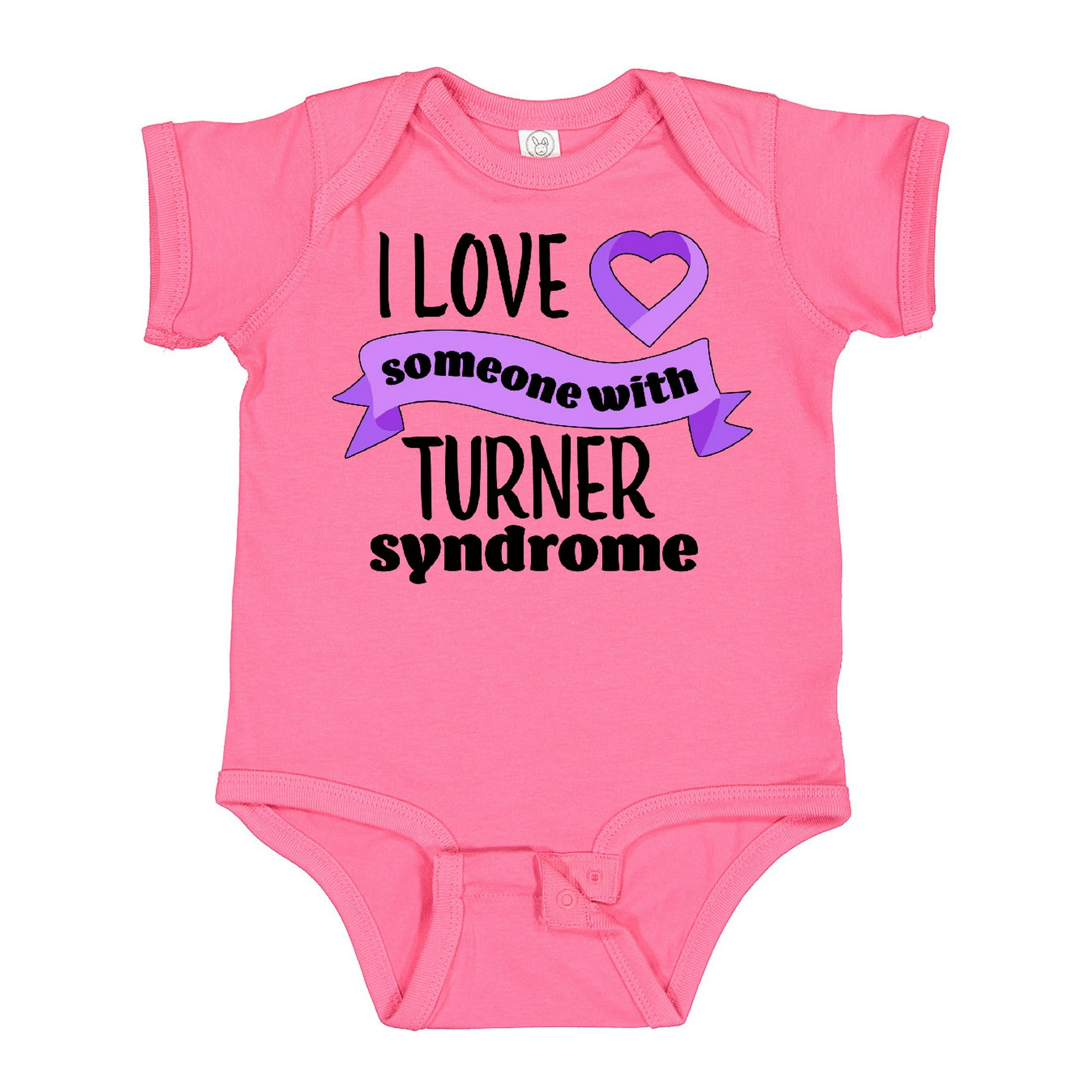 turner syndrome baby girl