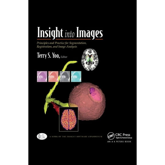 Insight into Images: Principles and Practice for Segmentation, Registration, and Image Analysis, (Hardcover)