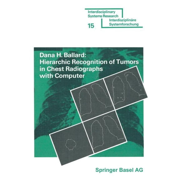 Interdisciplinary Systems Research Hierarchic Recognition of Tumors in Chest Radiographs with Computer, (Paperback)