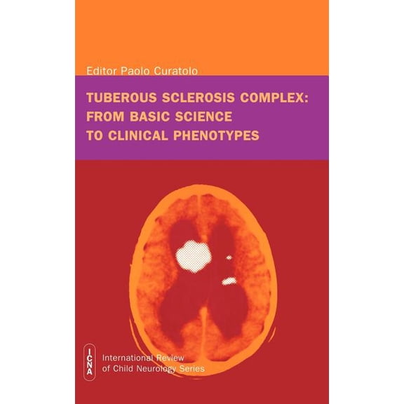 International Review of Child Neurology Tuberous sclerosis complex: from basic science to clinical phenotypes, (Hardcover)