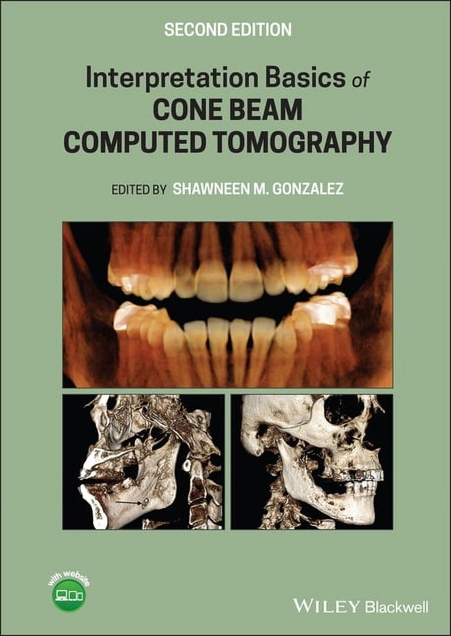 Interpretation Basics of Cone Beam Computed Tomography (Hardcover ...