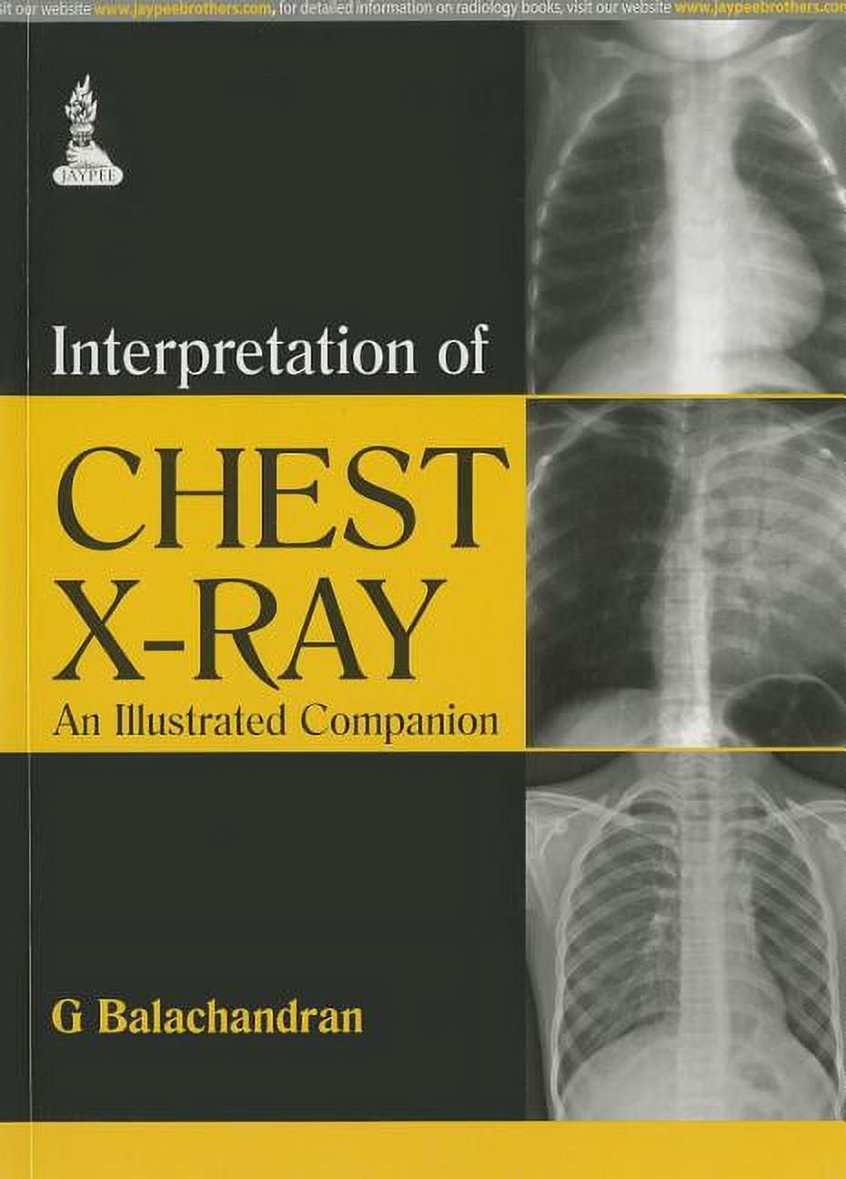 interpretation of chest x-ray an illustrated companion download