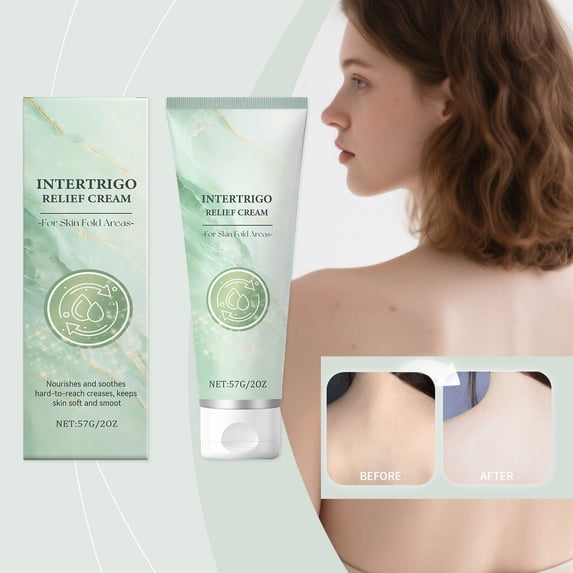 Intertrigo Cream, Skin Fold Care & Chafing Support Cream, Helps Soothe Irritated Skin, Reduce Moisture & Friction