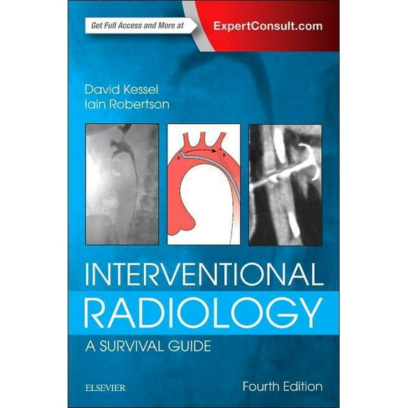 Interventional Radiology: A Survival Guide, (Paperback)