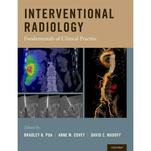 Interventional Radiology: Fundamentals of Clinical Practice, (Hardcover)