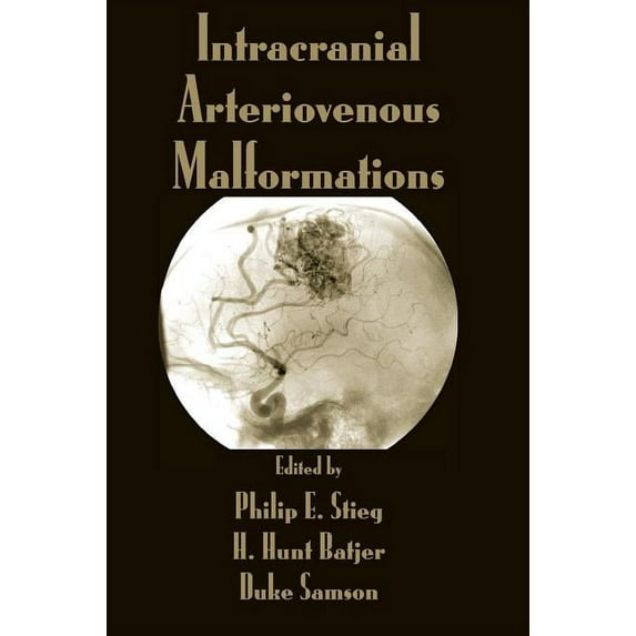 Intracranial Arteriovenous Malformations, (Hardcover)
