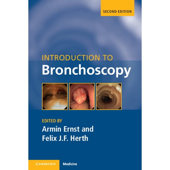 Introduction to Bronchoscopy, (Paperback)