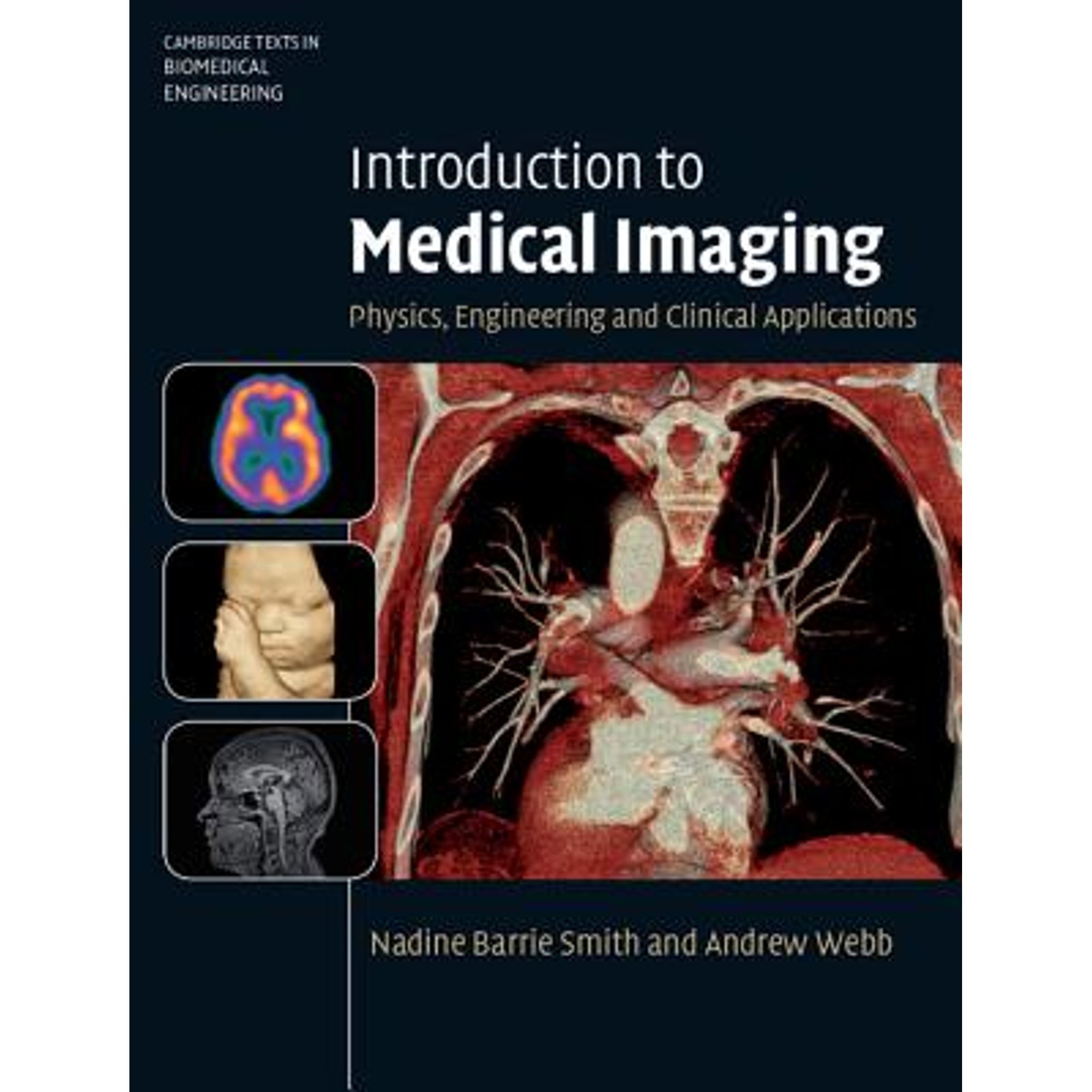 Pre-Owned Introduction to Medical Imaging: Physics, Engineering and Clinical Applications (Hardcover) 0521190657 9780521190657