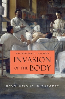 Pre-Owned Invasion of the Body: Revolutions in Surgery (Hardcover) 0674062280 9780674062283
