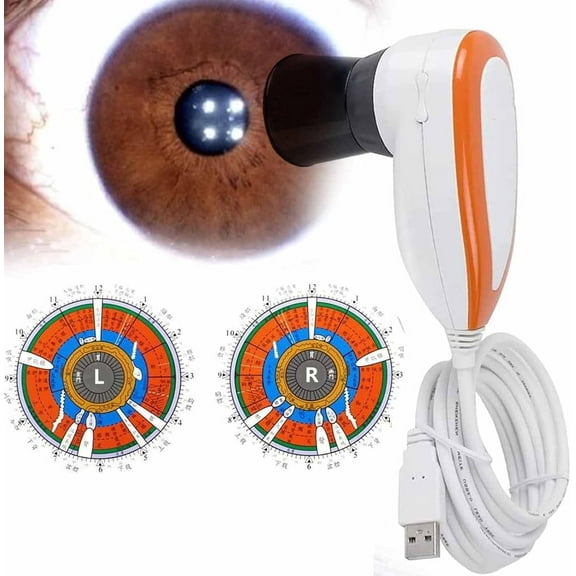 Iris Analysis Camera,Iris Detector Iris Analysis Camera with 30X Iris Lens and Analysis Software,5.0M Pixels USB Left/Right Lamp Analyzer/Analysis Iridology Camera,Resolution 2560 * 1920