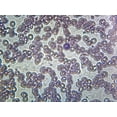 thumbnail image 1 of Iron-Deficient Anemia Blood (Human); Smear; GS Stain; Showing Peripheral Blood Film with Small, Pale Red Blood Cells by Go Science Crazy, 1 of 1