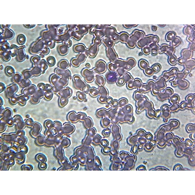 Iron-Deficient Anemia Blood (Human); Smear; GS Stain; Showing Peripheral Blood Film with Small, Pale Red Blood Cells by Go Science Crazy