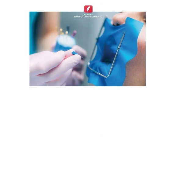 Irrigação endodôntica em pacientes diabéticos (Paperback)
