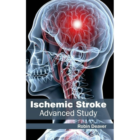 Ischemic Stroke: Advanced Study, (Hardcover)