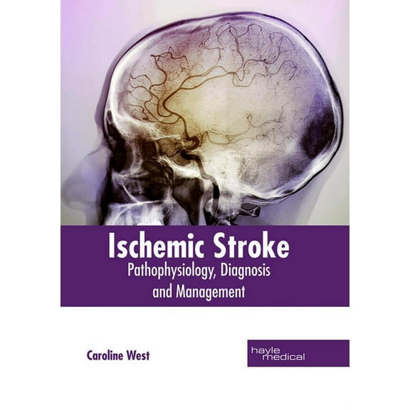 Ischemic Stroke: Pathophysiology, Diagnosis and Management, (Hardcover)