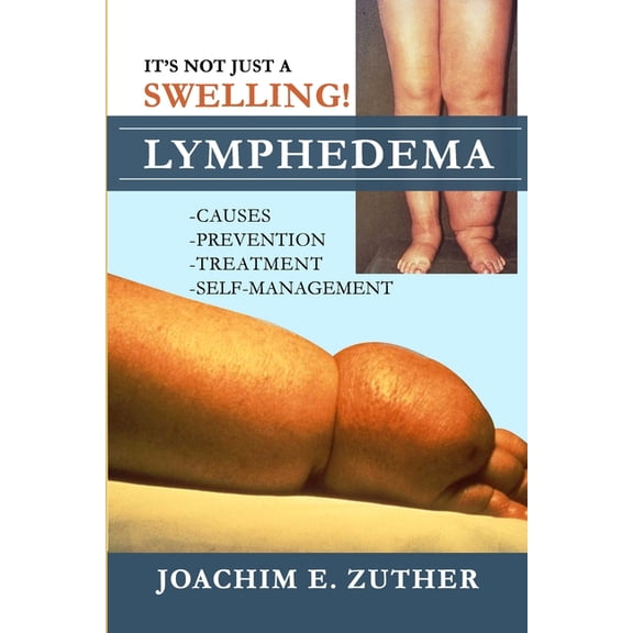 It's Not Just a Swelling! Lymphedema: Causes, Prevention, Treatment, Self-Management, (Paperback)
