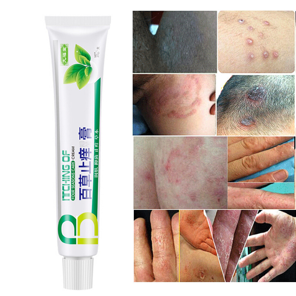 Itching Cream Herbal 20g Medicine Relieve Itching Antibacterial Health